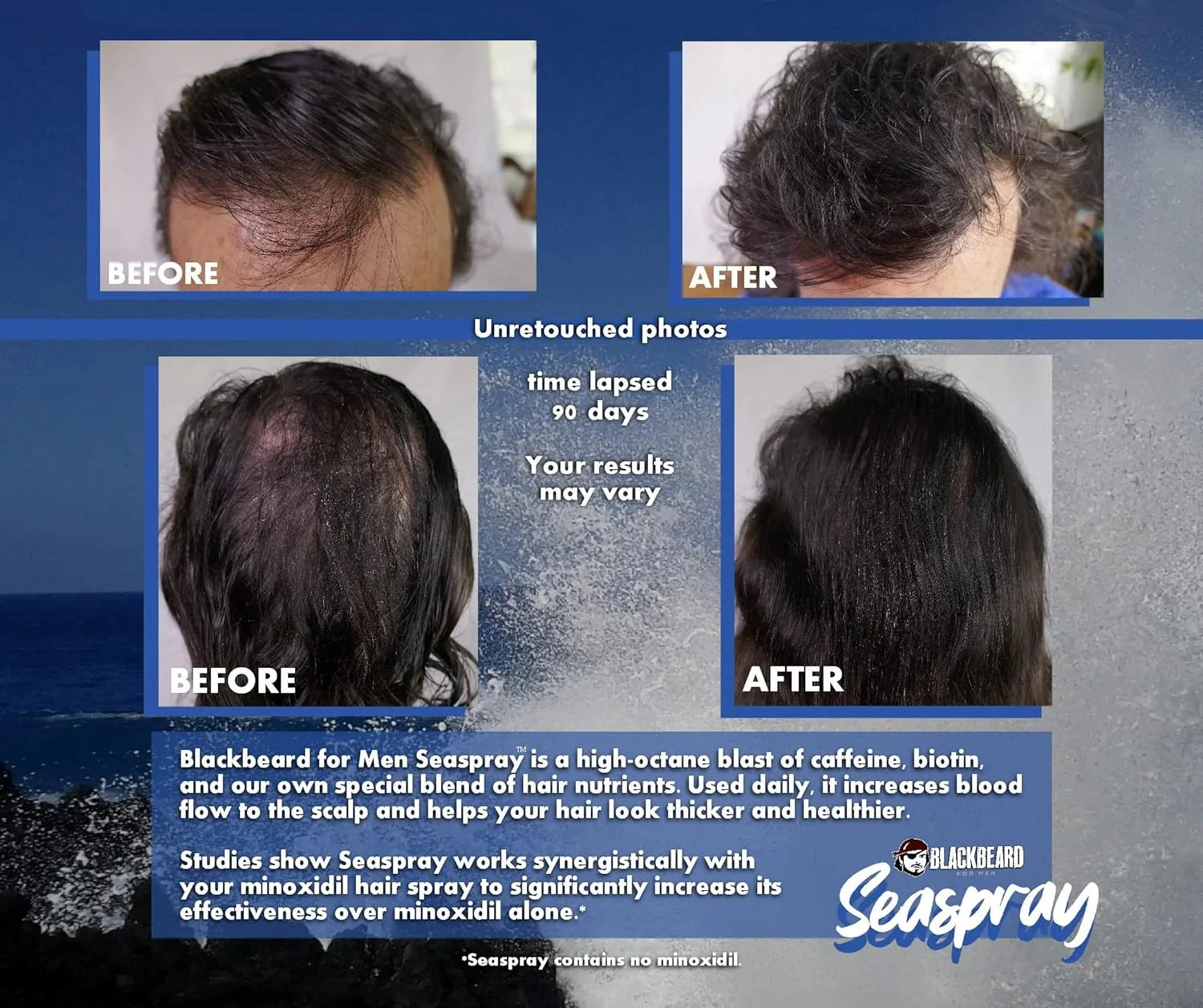 Blackbeard Seaspray Hair Energizer - Men'S Hair Serum Spray with Biotin and Caffeine, Volumizer for Thicker, Fuller Hair, Hair Thinning Treatment, 2.1 Fl Oz. (60 Ml)